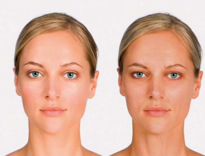 Gesiicht no a virun der Rejuvenatioun